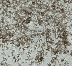 Cladosporium