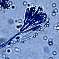 Penicillium Mold