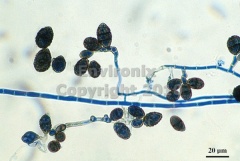 Ulocladium Mold