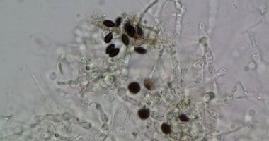 Types of Mold - Environix